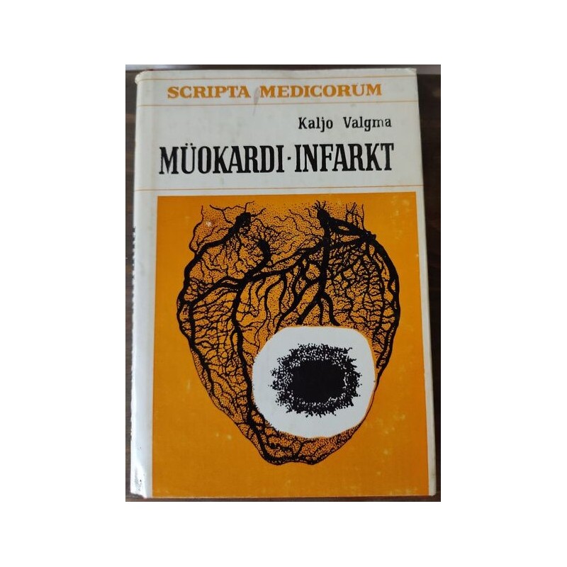 Müokardi-infarkt